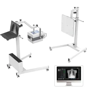 Portable High Frequency Digital X-Ray Machine - Human and Veterinary Radiography for Medical Diagnosis I Model MMSLGX11