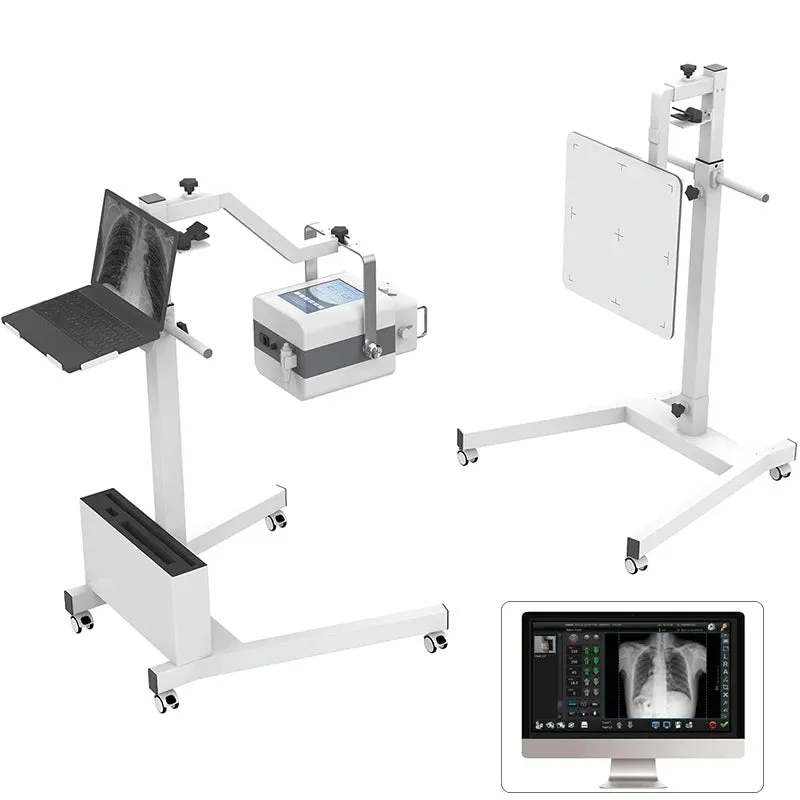 Portable High Frequency Digital X-Ray Machine - Human and Veterinary Radiography for Medical Diagnosis I Model MMSLGX11