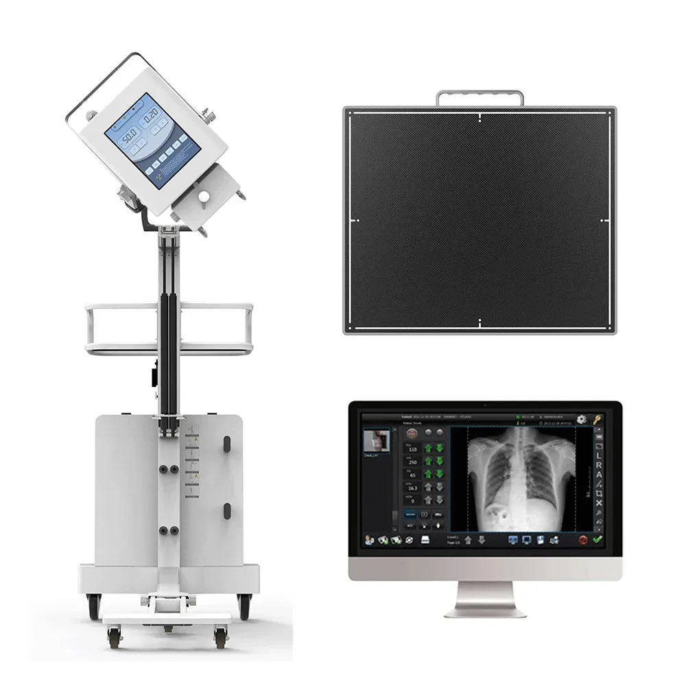 Portable High Frequency Digital X-Ray Machine - Human and Veterinary Radiography for Medical Diagnosis I Model MMSLGX11